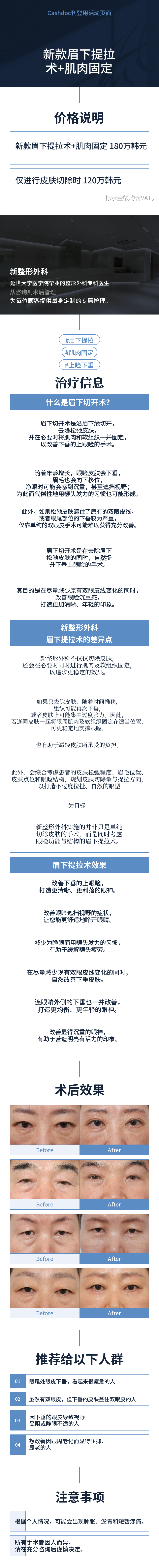 [新] 眉毛提升术 + 肌肉固定