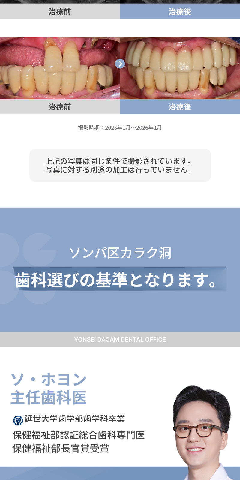 無切開インプラント、オステムBA