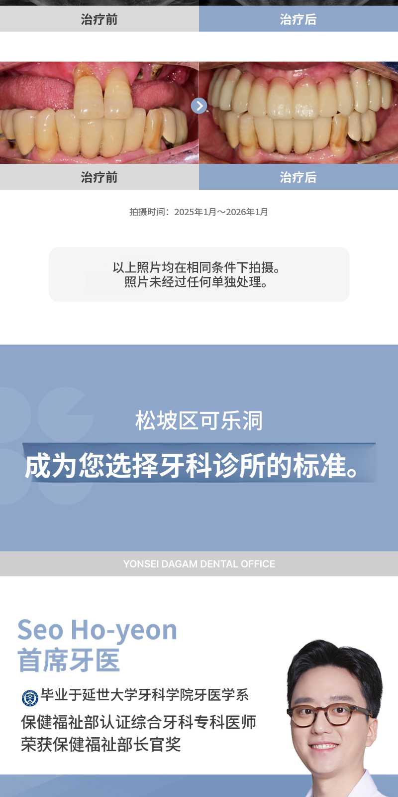 无切口种植牙，奥齿泰 BA