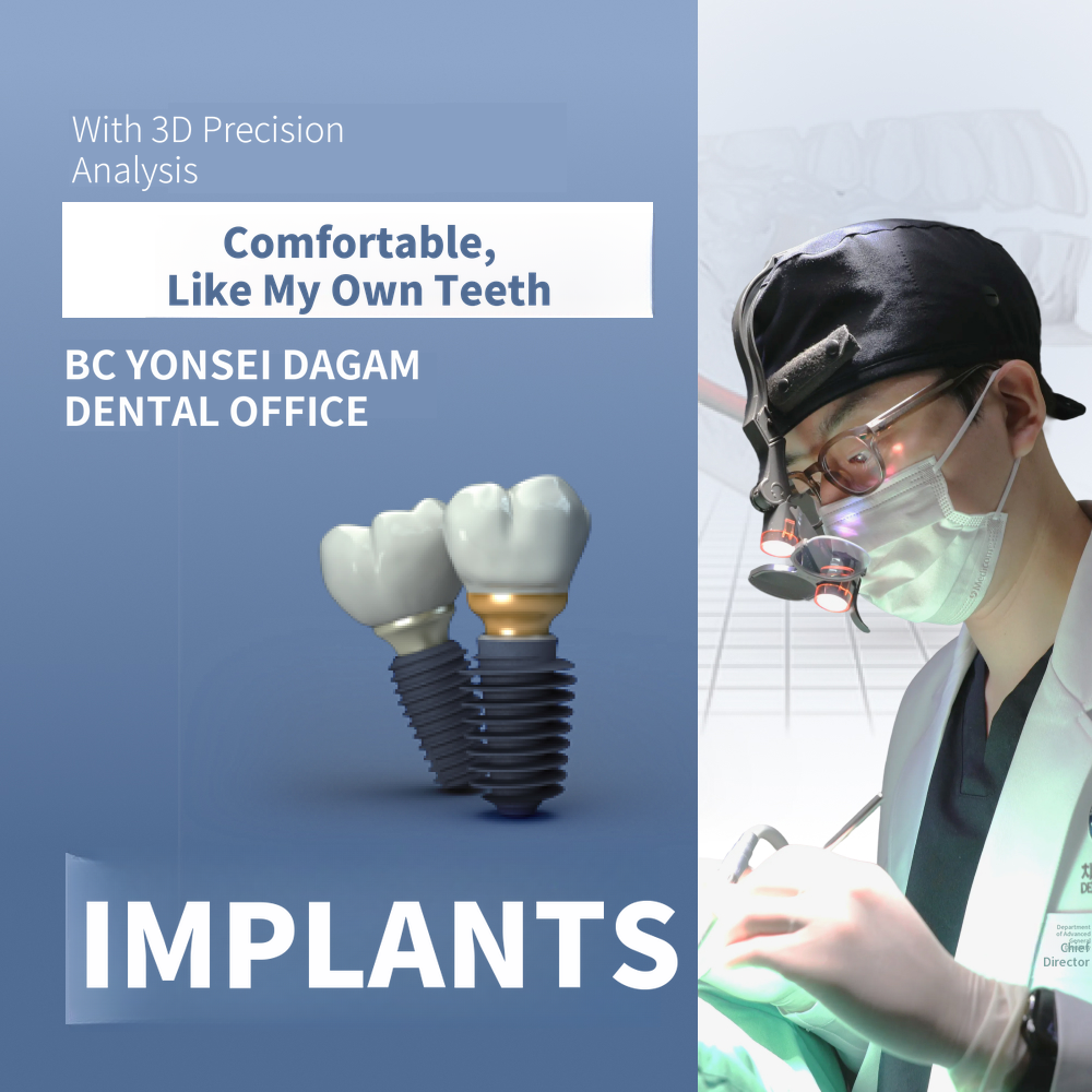 Flapless Dental Implants, Osstem BA