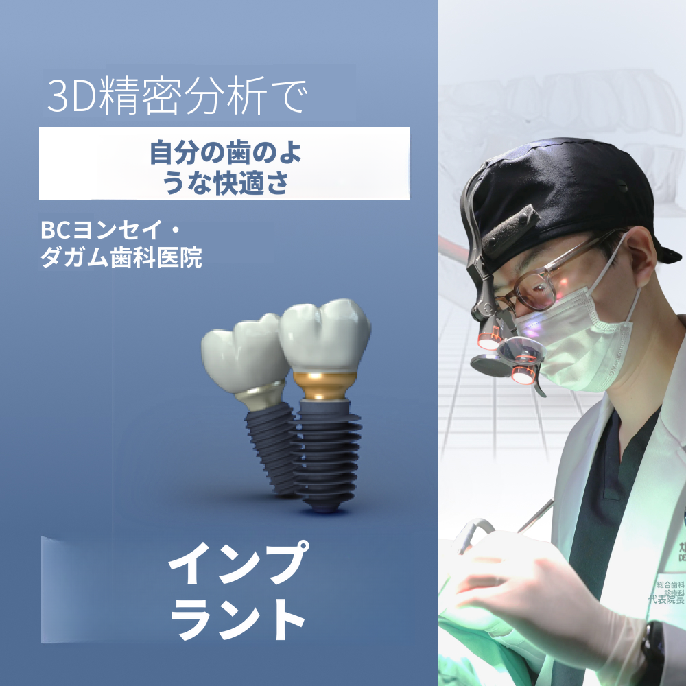 無切開インプラント、オステムBA