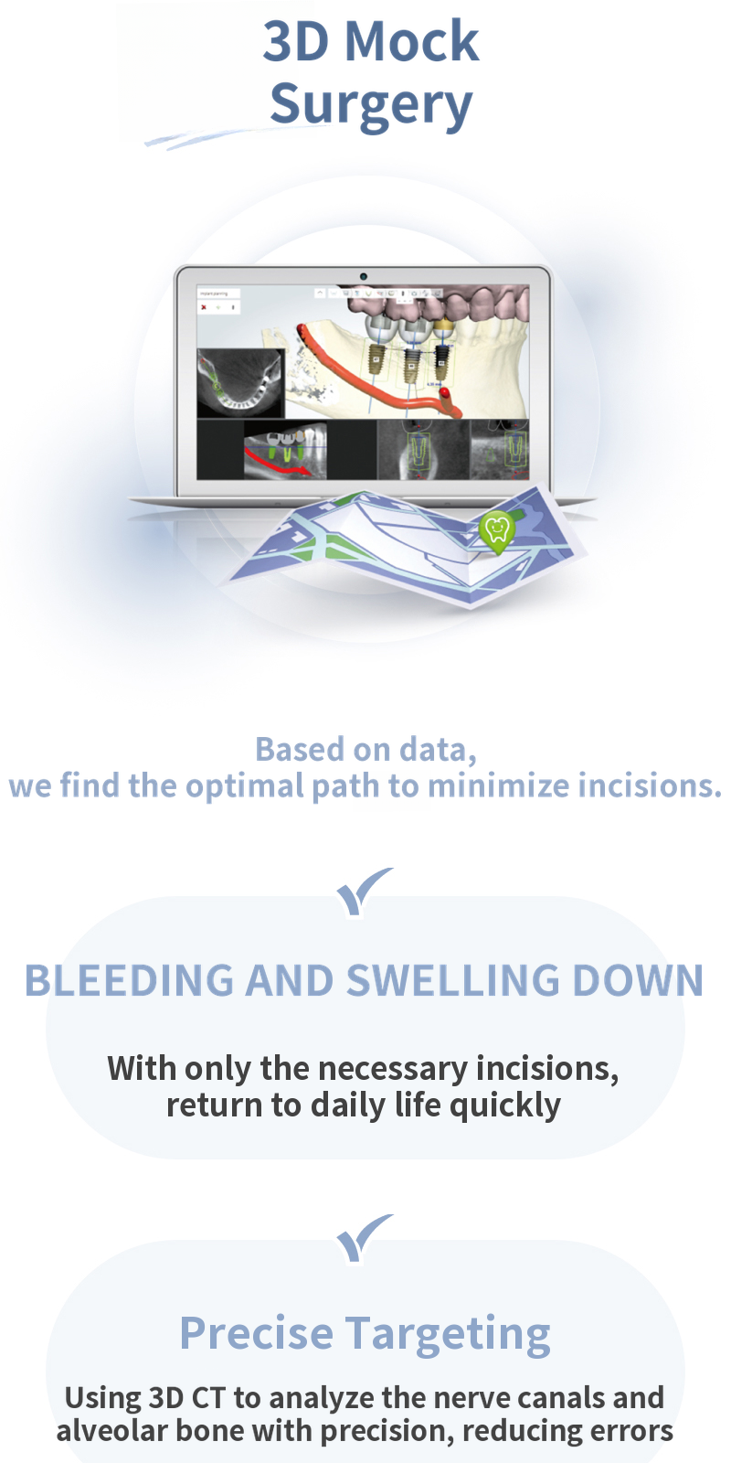 Flapless Dental Implants, Osstem SOI