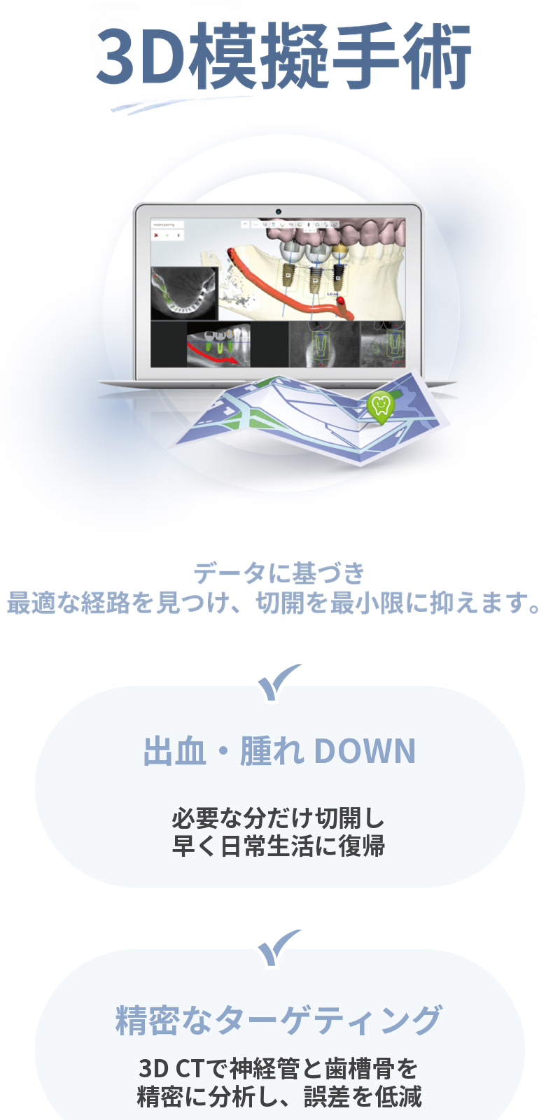 無切開インプラント、オステム SOI