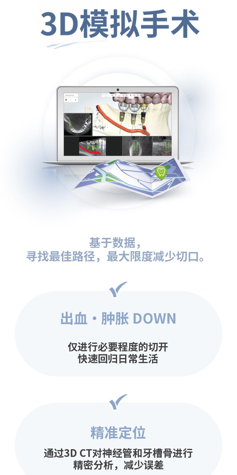 无切口种植牙，奥齿泰 SOI