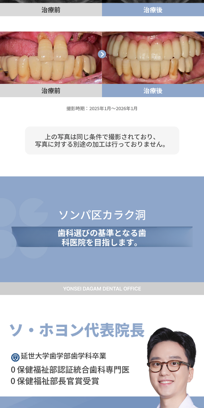 無切開インプラント、オステム SOI