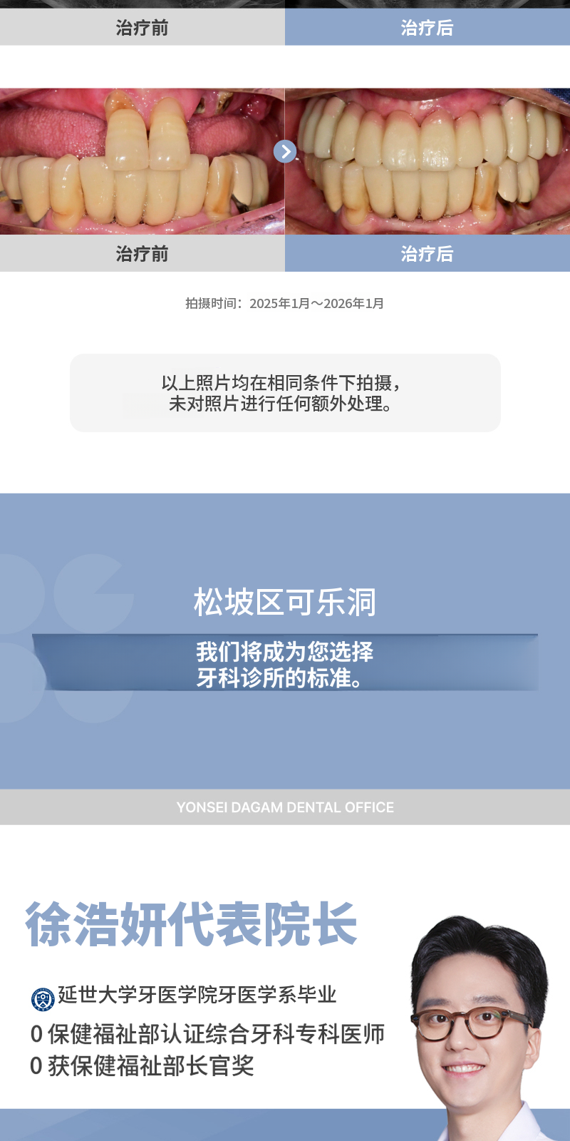无切口种植牙，奥齿泰 SOI