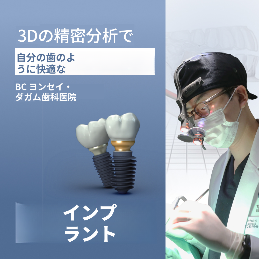 無切開インプラント、オステム SOI
