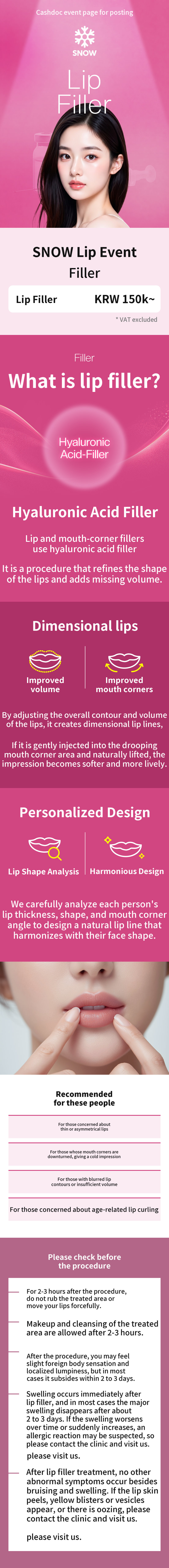 Lip Filler