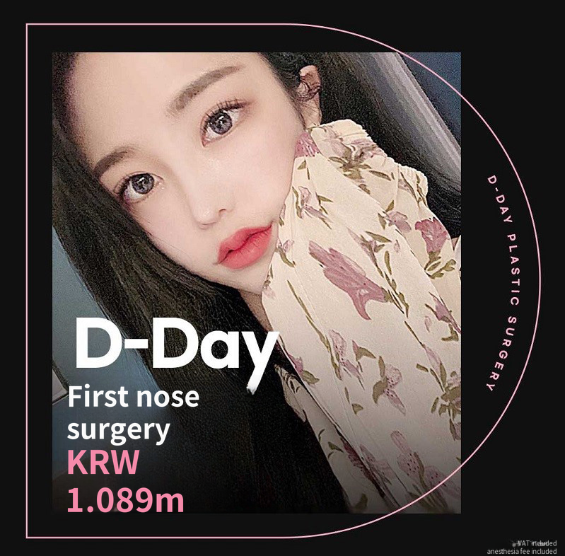 D-Day for Korean! First D-Day Plastic Surgery!
