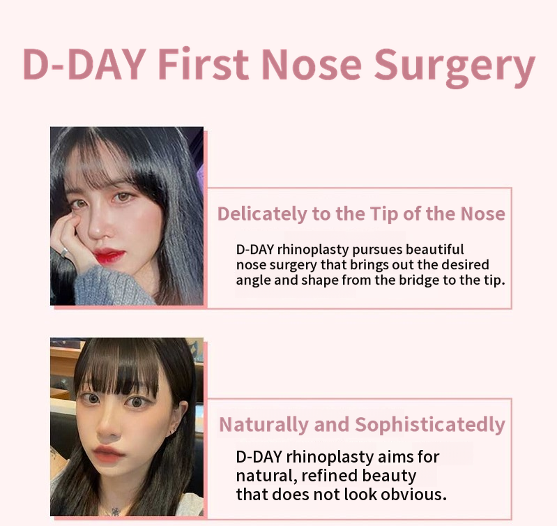 D-Day for Korean! First D-Day Plastic Surgery!