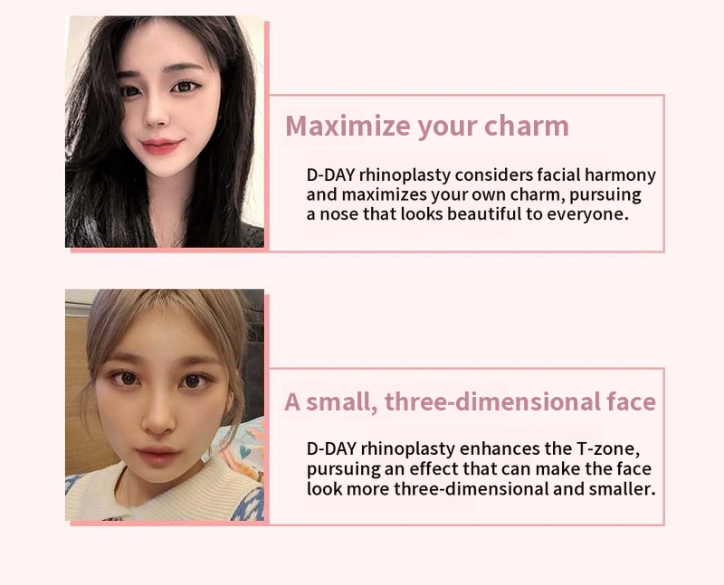 D-Day for Korean! First D-Day Plastic Surgery!