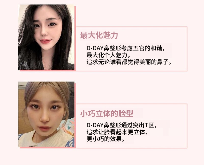 科拉因的关键时刻!关键时刻初次整形!