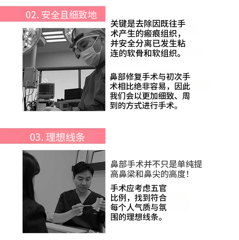 科拉因的关键时刻!关键时刻初次整形!