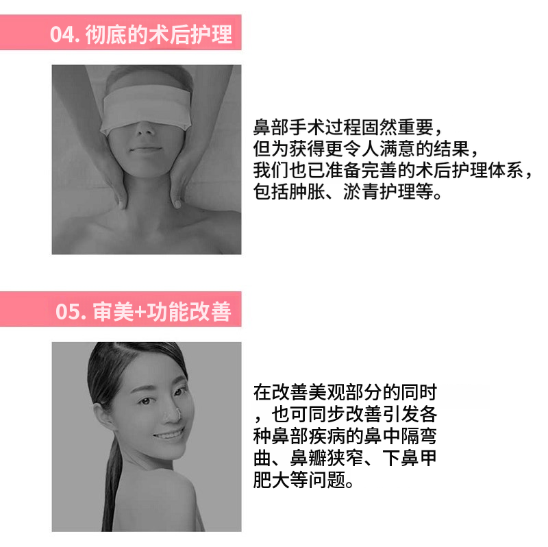 科拉因的关键时刻!关键时刻初次整形!