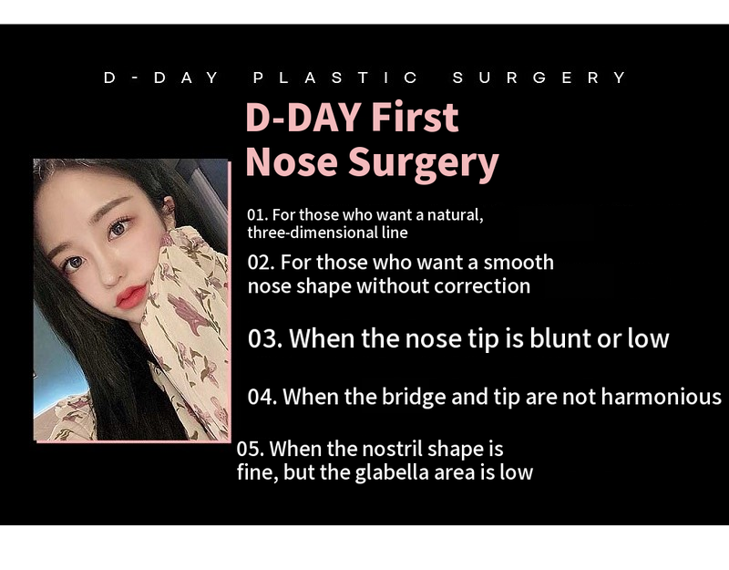 D-Day for Korean! First D-Day Plastic Surgery!