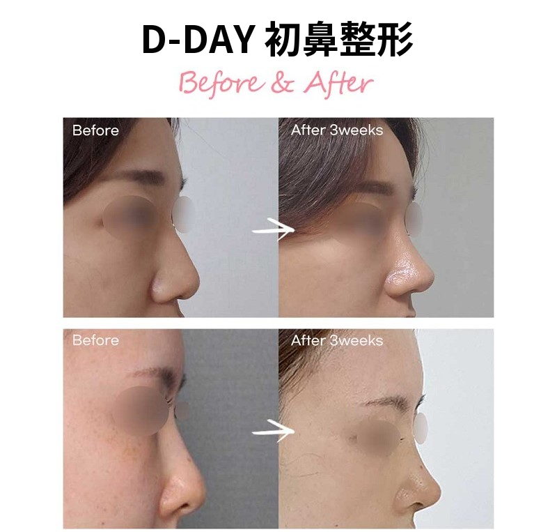 コラインはD-Dayです!D-Day初のコスチューマー!