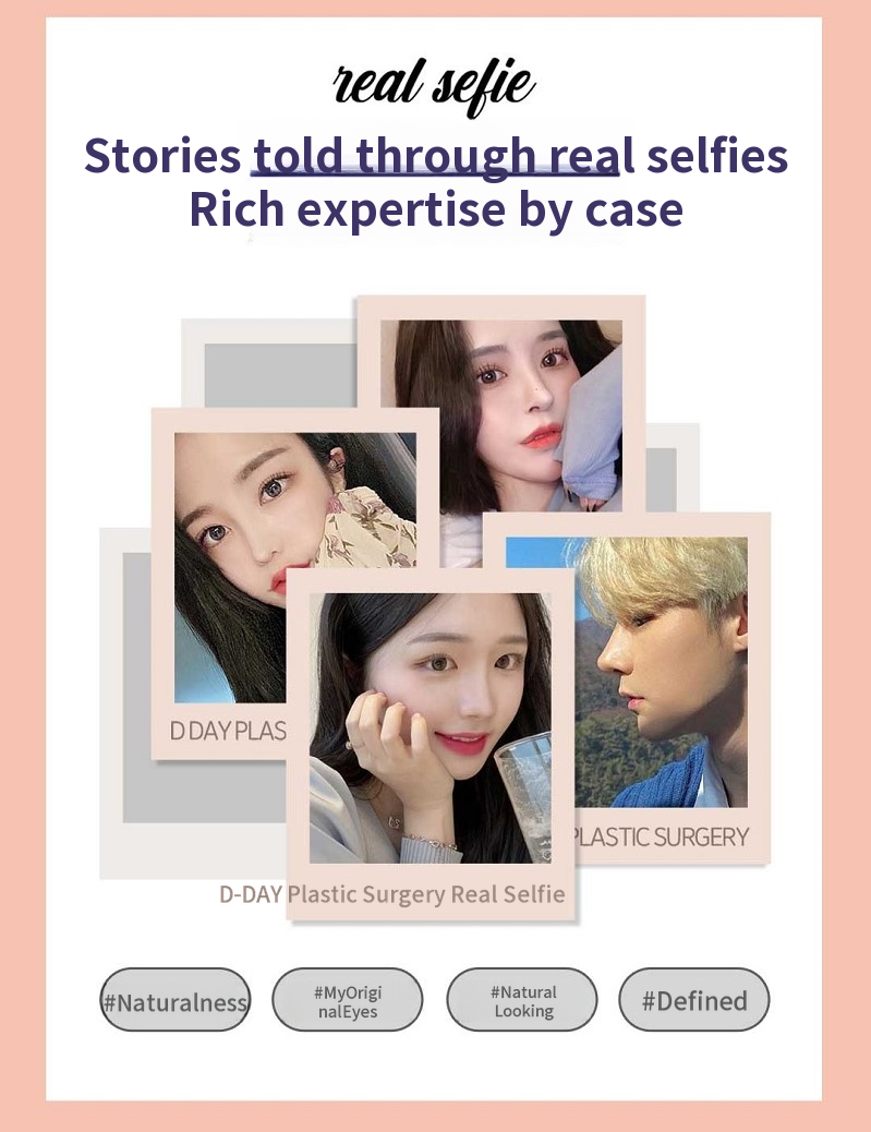 D-Day for Korean! First D-Day Plastic Surgery!