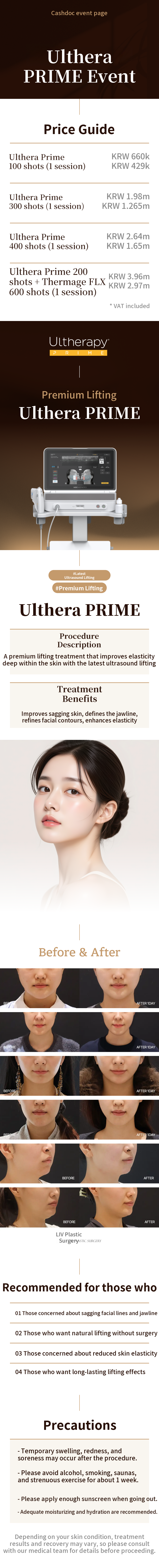 Ultherapy Prime 100 Shots