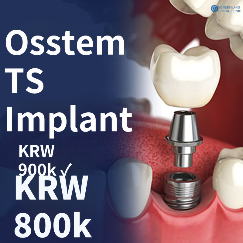 Ostem TS Implant - Integrated Dental Medicine Specialist Consultation