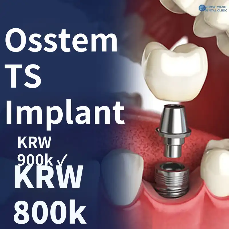 Ostem TS Implant - Integrated Dental Medicine Specialist Consultation