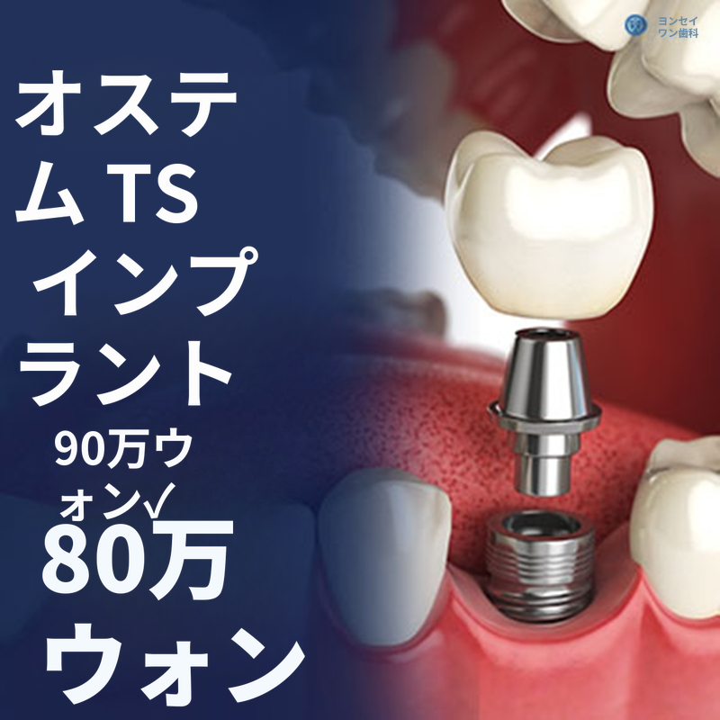オステム TS インプラント - 統合歯科専門医の診療
