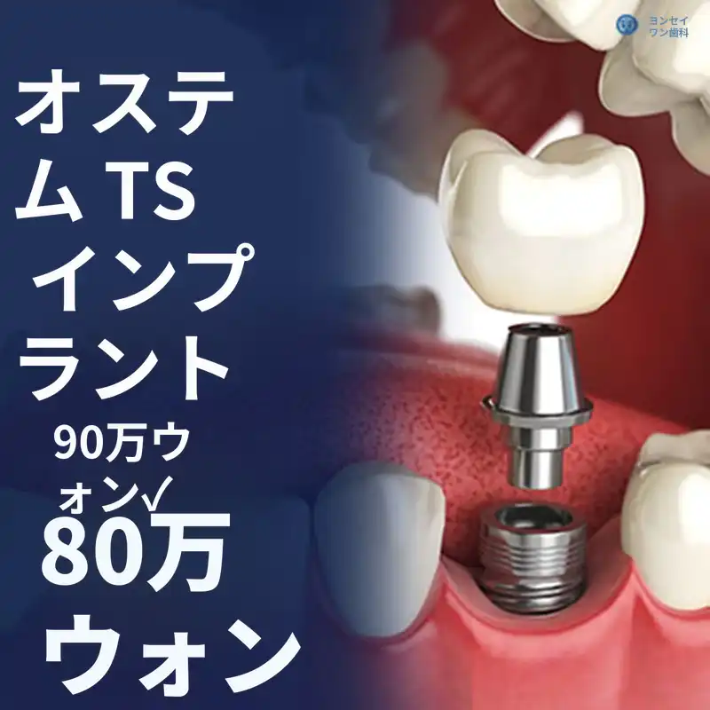 オステム TS インプラント - 統合歯科専門医の診療