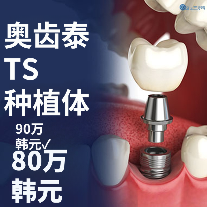 奥斯特姆 TS 种植体 - 综合牙医学科专业医生诊疗