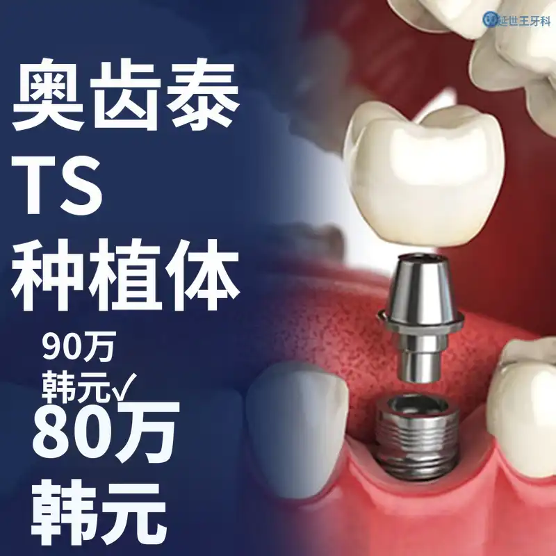 奥斯特姆 TS 种植体 - 综合牙医学科专业医生诊疗
