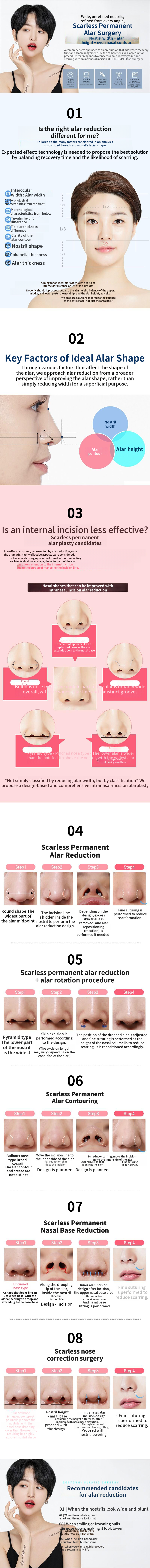 Scar-free permanent medial incision alar reduction