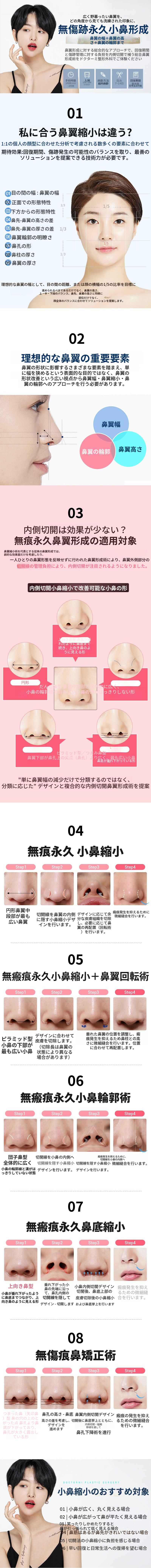 無傷永久内側切開鼻翼縮小
