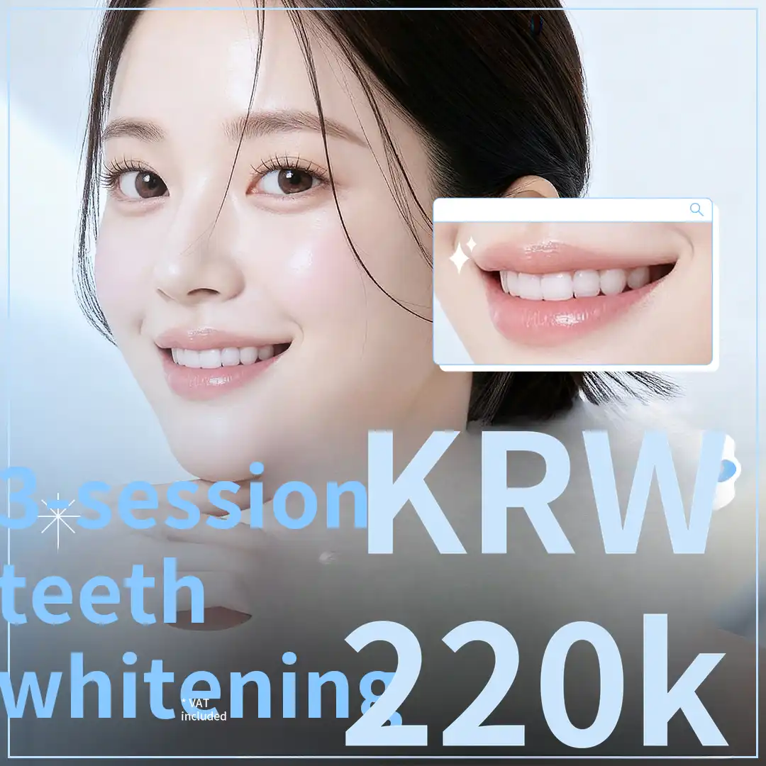 Teeth Whitening 3-Session Event for a Bright and Clean Smile