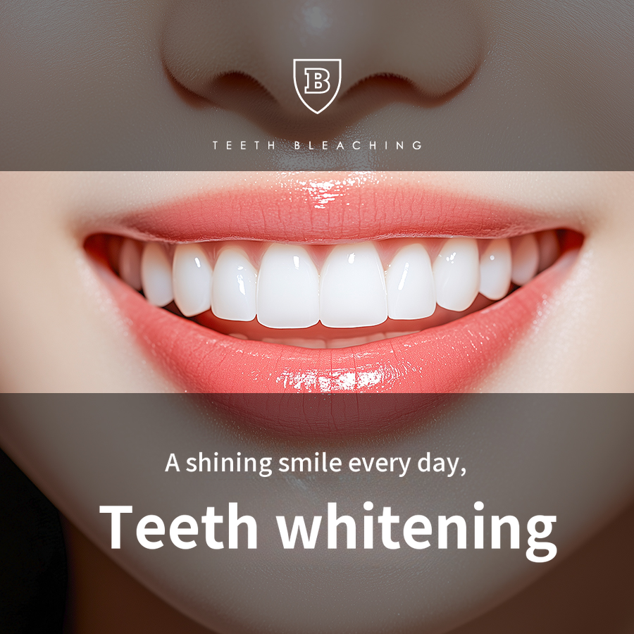One-Day Teeth Whitening: 3-Session Full Course (Including Dental Scaling)