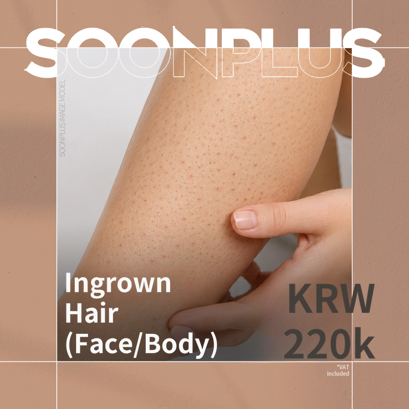 Soon Plus_Ingrown Hair