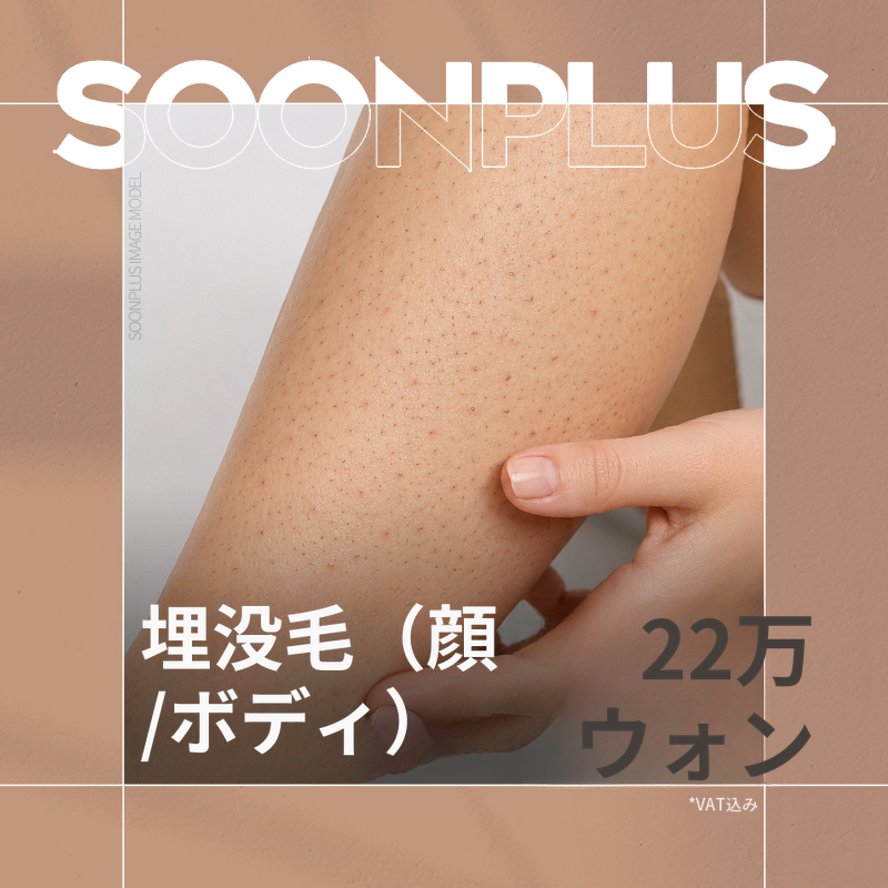 スンプラス_埋没毛