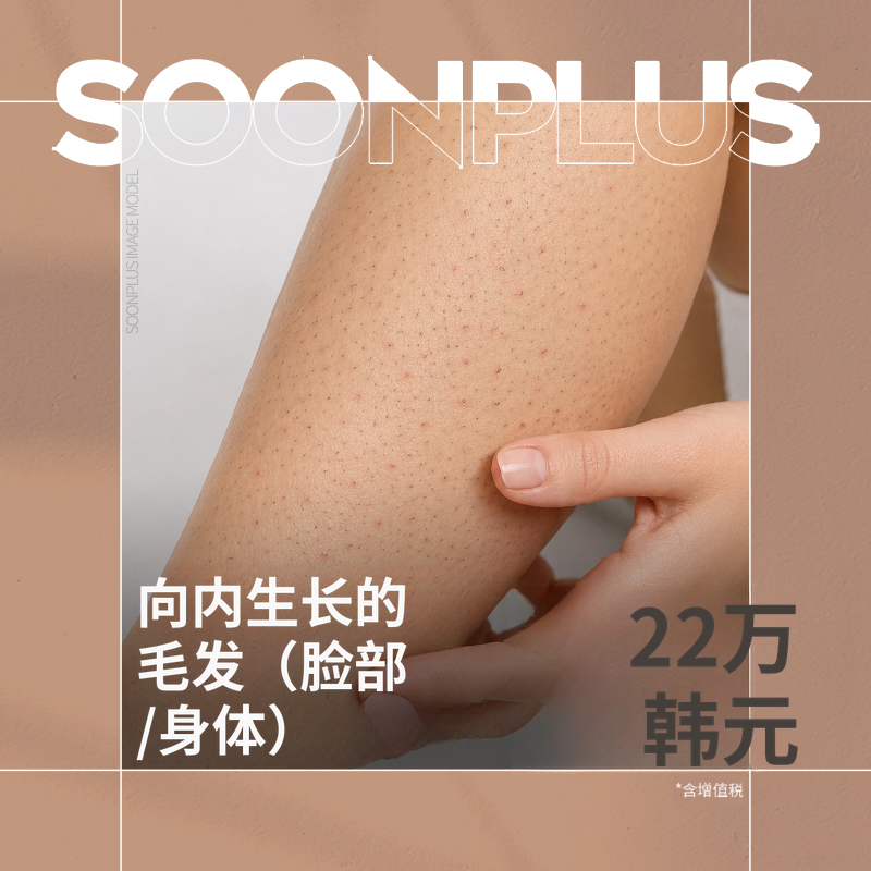顺普拉斯_毛发内生