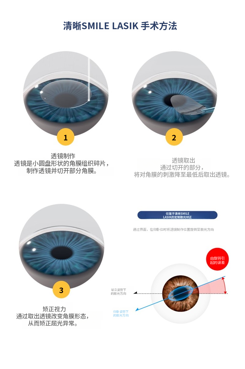 克利尔全飞秒