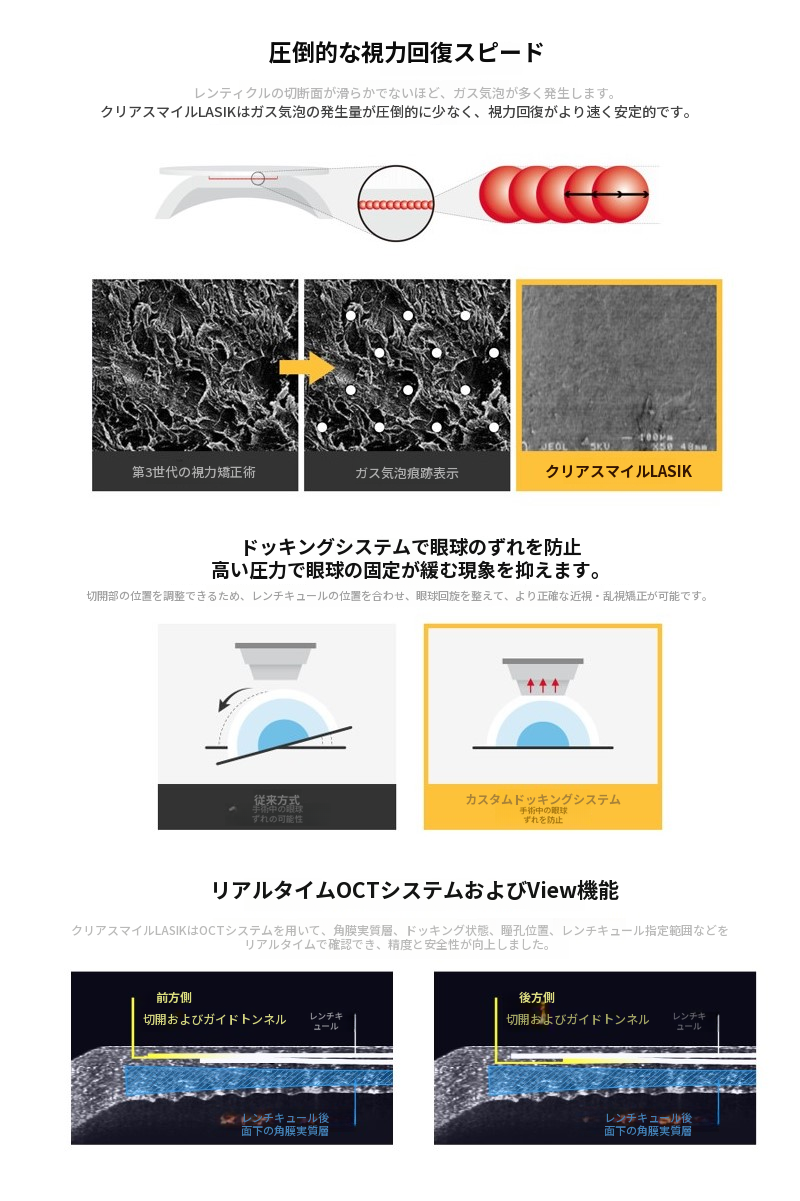 クリアスマイルレーシック