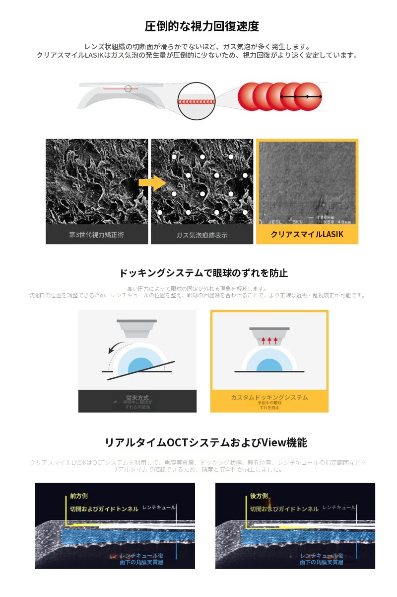 クリアスマイルレーシック