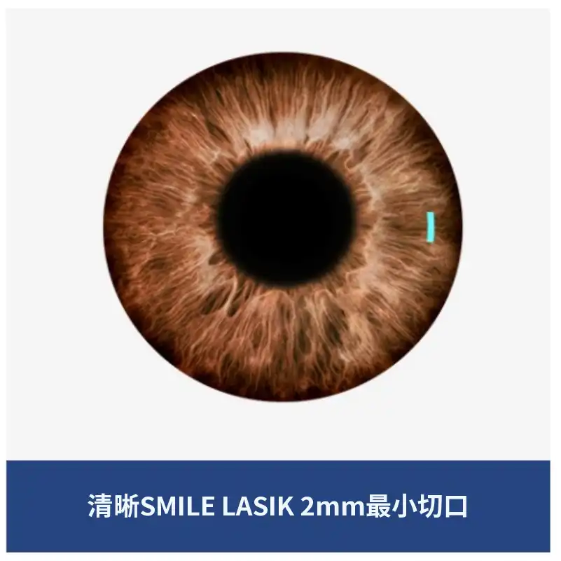 克利尔全飞秒