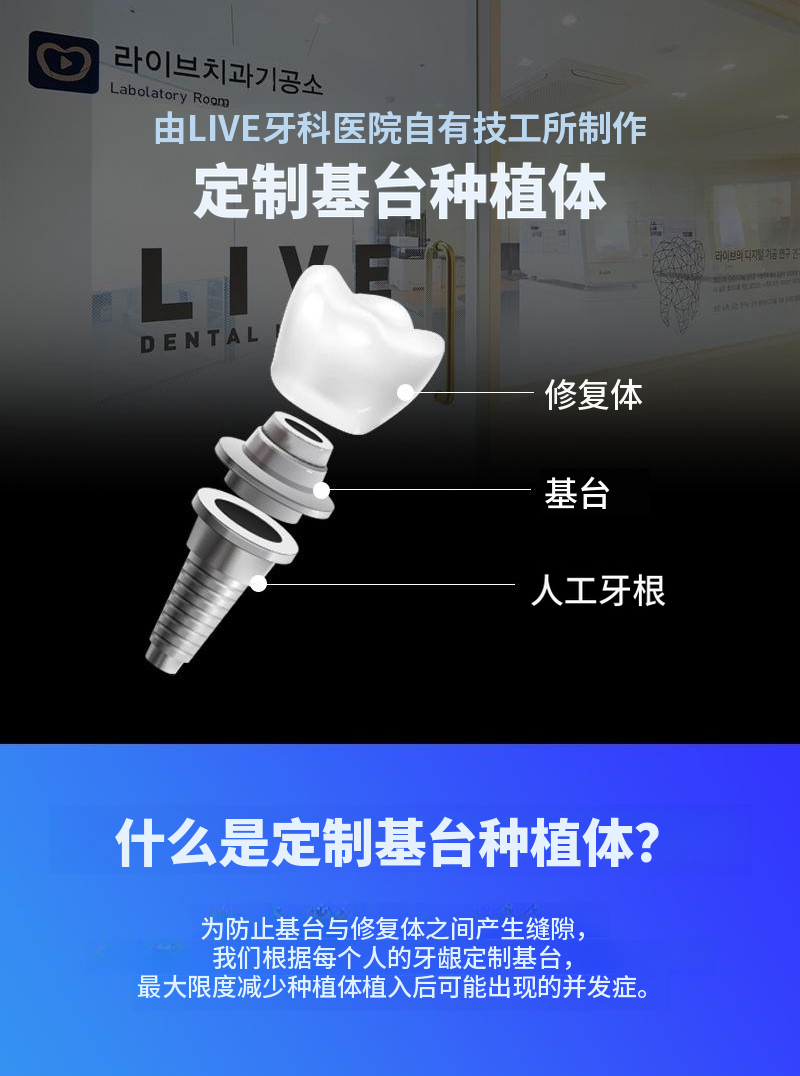单颌全口种植牙4期分期特价
