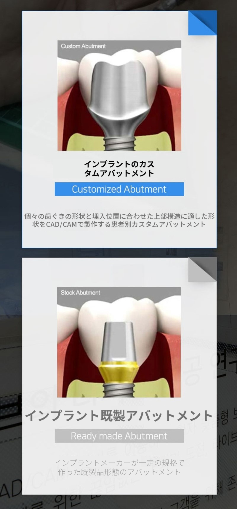 片顎フルアーチインプラント4回分割払い特別価格