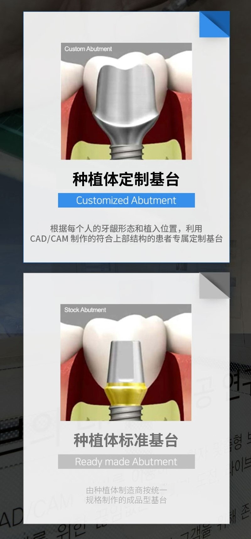 单颌全口种植牙，分4期付款特价