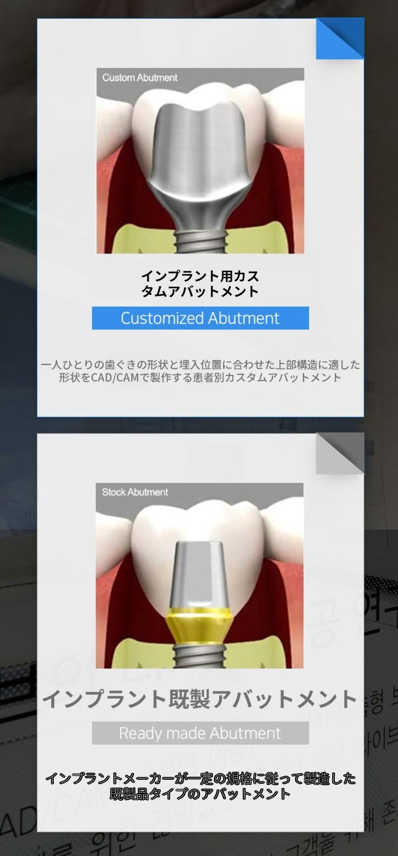 片顎全顎インプラント4回分割払い特別価格