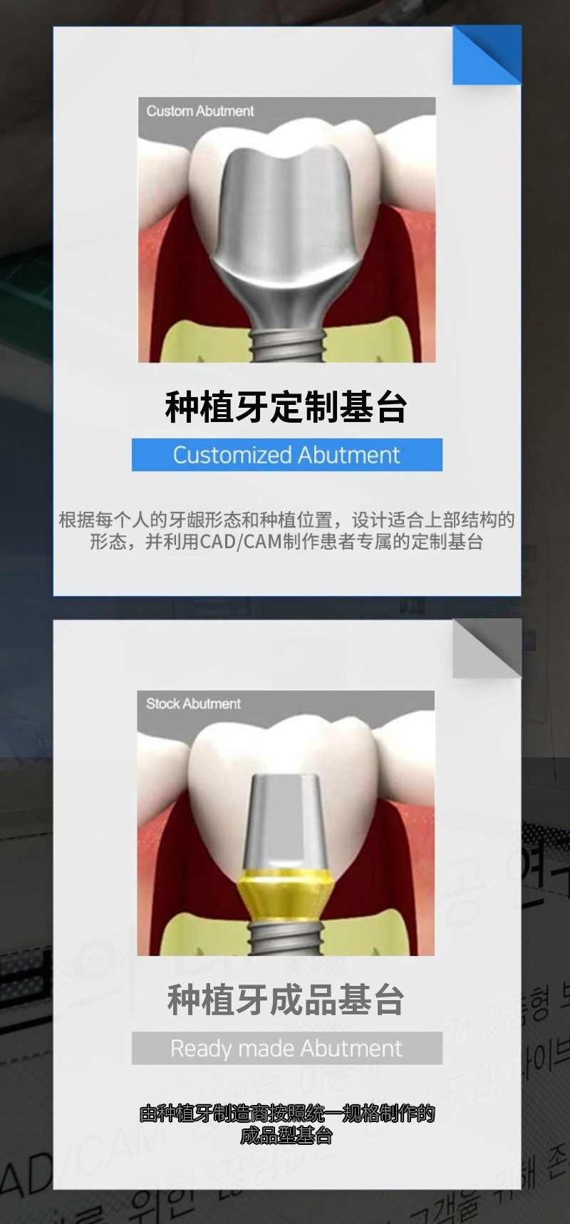 单颌全口种植牙4期分期特价