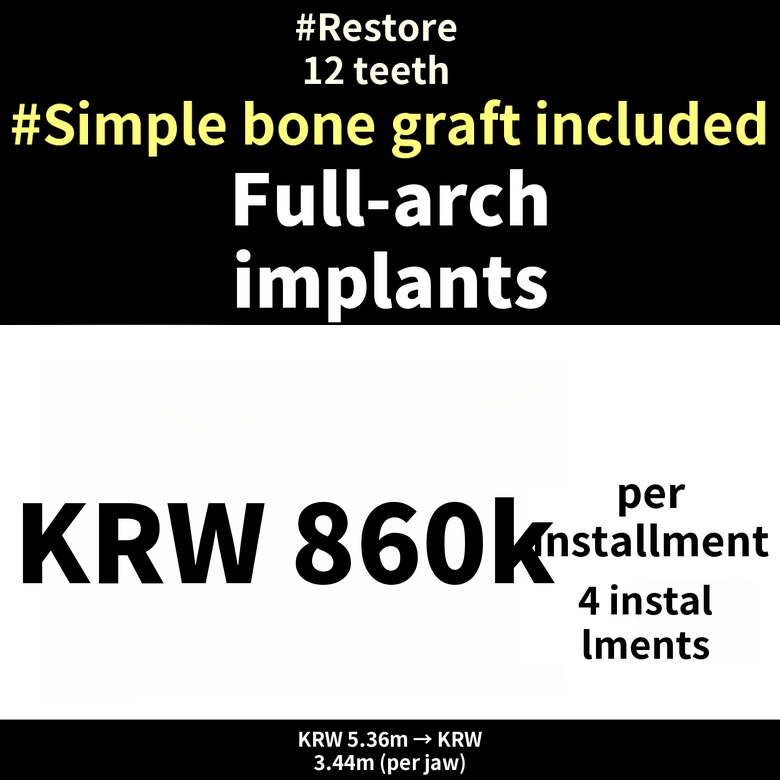 Full-Arch Dental Implants for One Jaw – Special Price with 4 Installment Payments