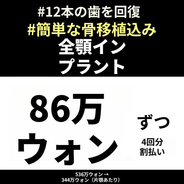 片顎全顎インプラント4回分割払い特別価格