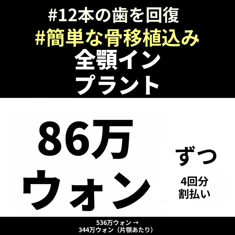 片顎全顎インプラント4回分割払い特別価格