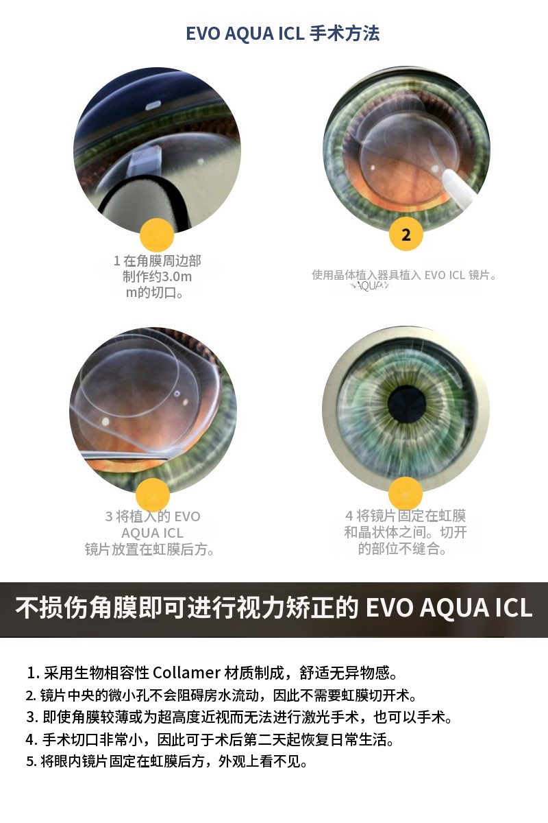 EVO AQUA ICL