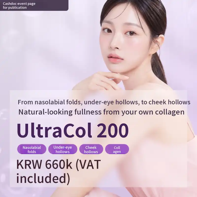 UltraCol for under-eye hollows, nasolabial folds, and hollow cheeks
