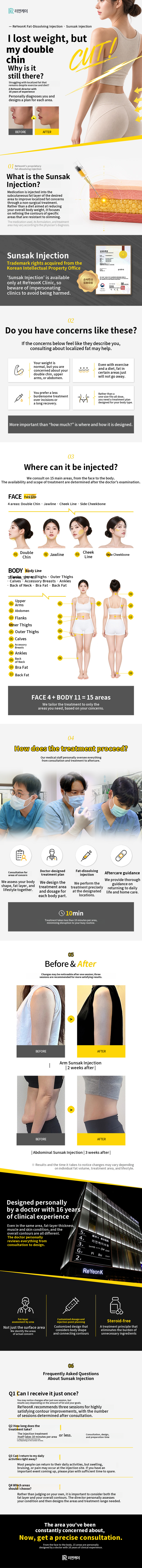 NO-steroid fat-dissolving injection for instant double-chin reduction